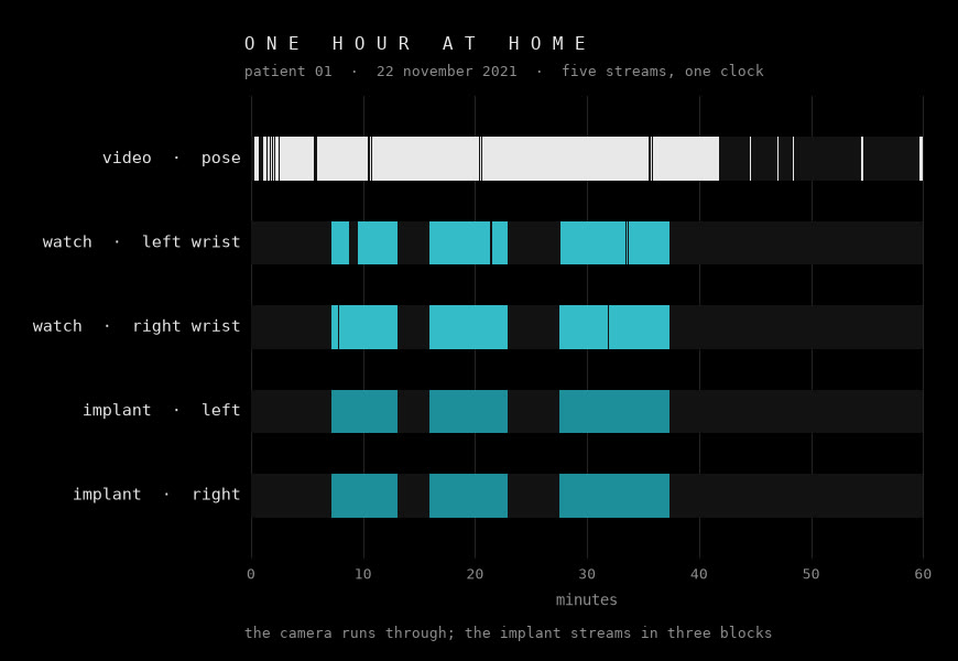 Five lanes over one hour at home, each marking when that stream was recording: video pose runs almost continuously across the hour, while the two wrist watches and the left and right implants stream in three synchronized blocks, with short breaks inside them where the watch dropped samples.